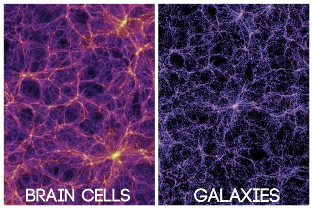 Cosmic web vs brain